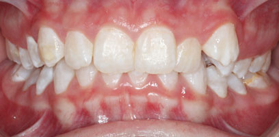 Before & Afters Before & Afters