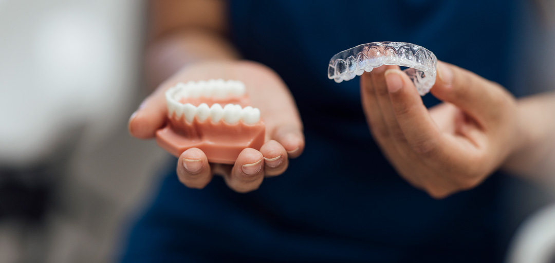 Invisalign® vs Braces: Which Is Best for You?