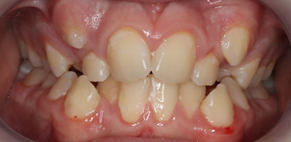 Before & Afters Before & Afters