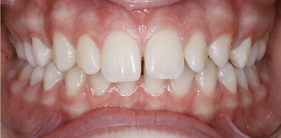 Before & Afters Before & Afters