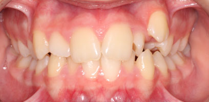 Before & Afters Before & Afters