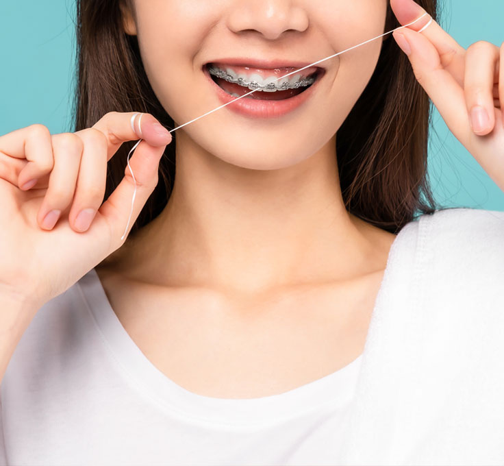 Flossing with braces