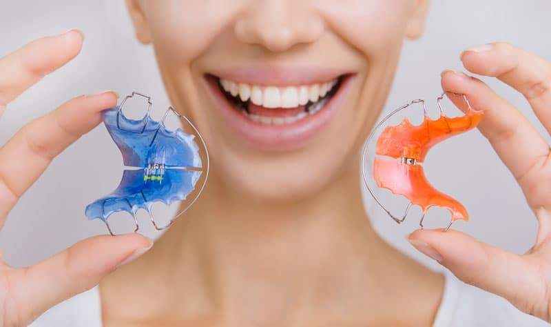 Why Retainers Are Important After Braces