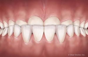 10 Most Common Orthodontic Problems